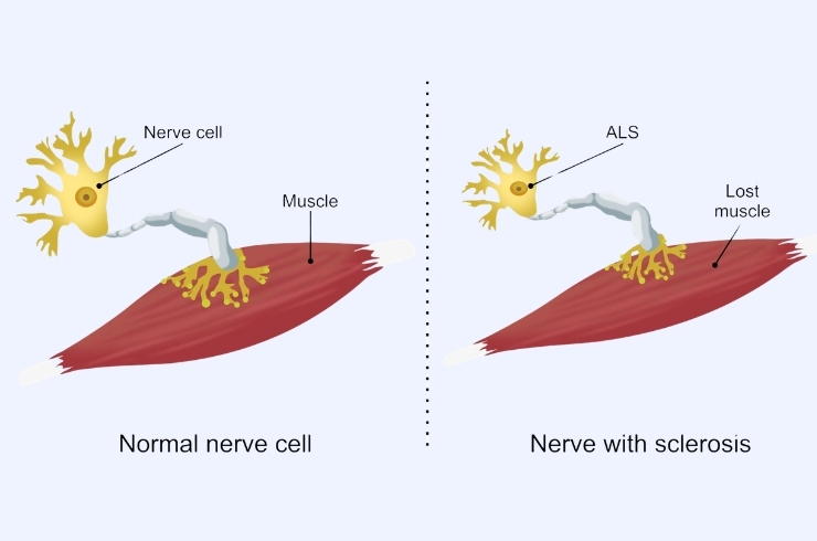 Breeze Multidisciplinary Rehabilitation