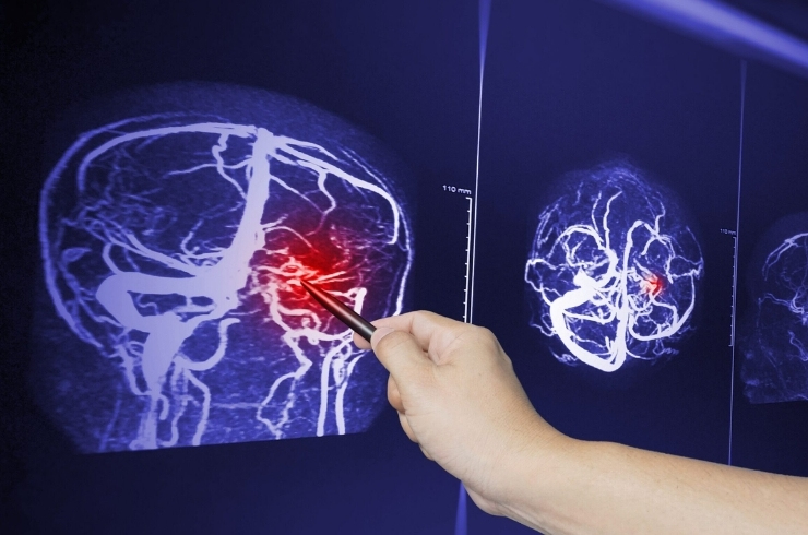 Breeze Multidisciplinary Rehabilitation